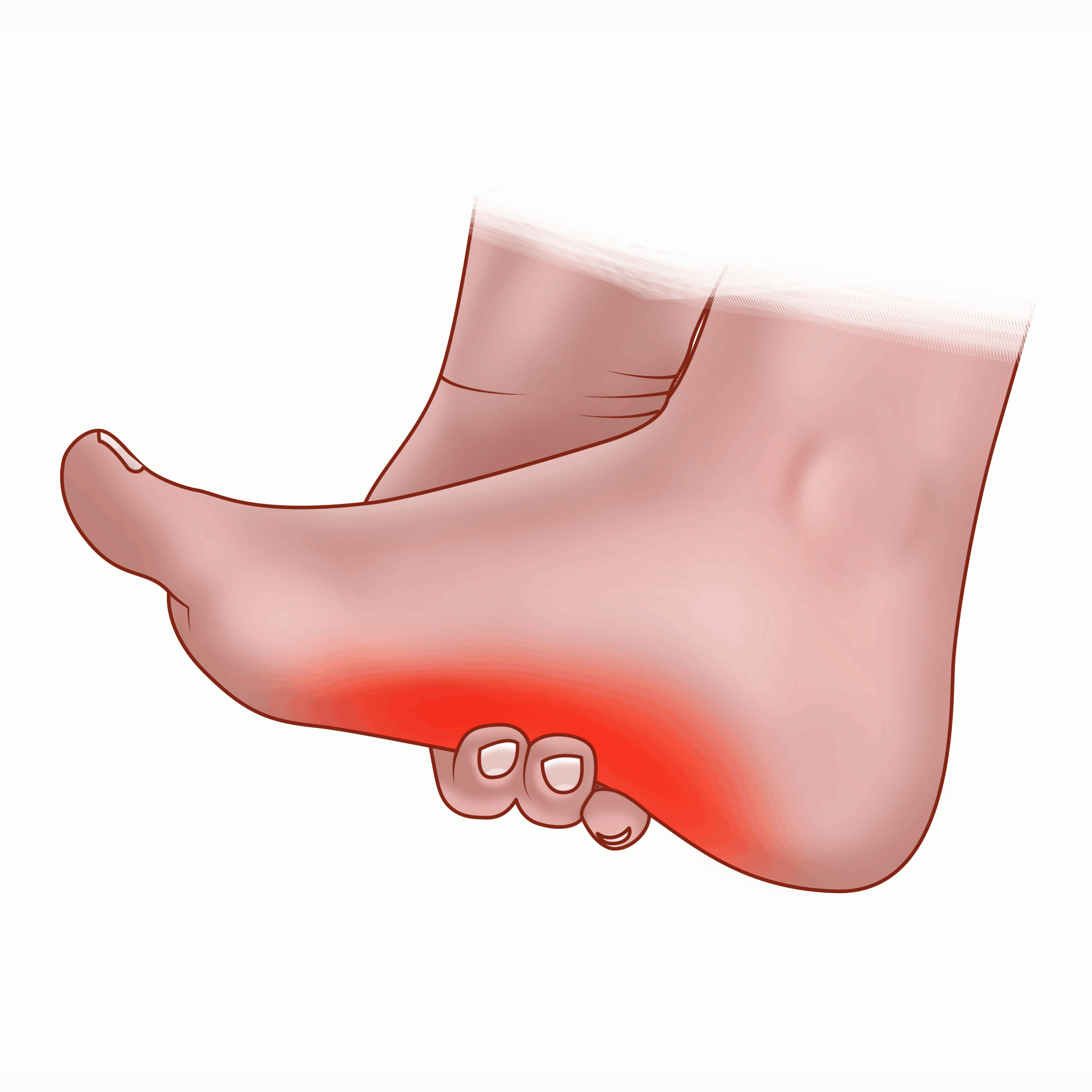 Aviation Podiatry